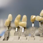 Obecna technika wykorzystywana w salonach stomatologii estetycznej być może sprawić, że odzyskamy prześliczny uśmiech.